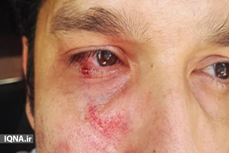 برخورد فیزیکی با مامور بهداشت،شایسته جامعه اسلامی نیست/ با فرد خاطی برخورد قاطع شود/ ارسالی یکشنبه برخورد فیزیکی با مامور بهداشت،شایسته جامعه اسلامی نیست/ با فرد خاطی برخورد قاطع شود/ ارسالی یکشنبه